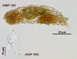 Image courtesy of ANSP (Jersabek et al. 2003) <a href='../../Reference/Index/15798' target='_blank'>[Ref.15798]</a>; female and trophi (lateral views)